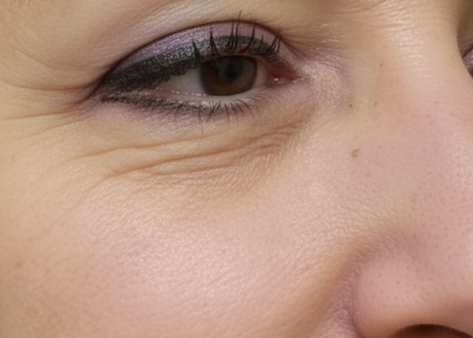 البوتكس غاليا روتس3