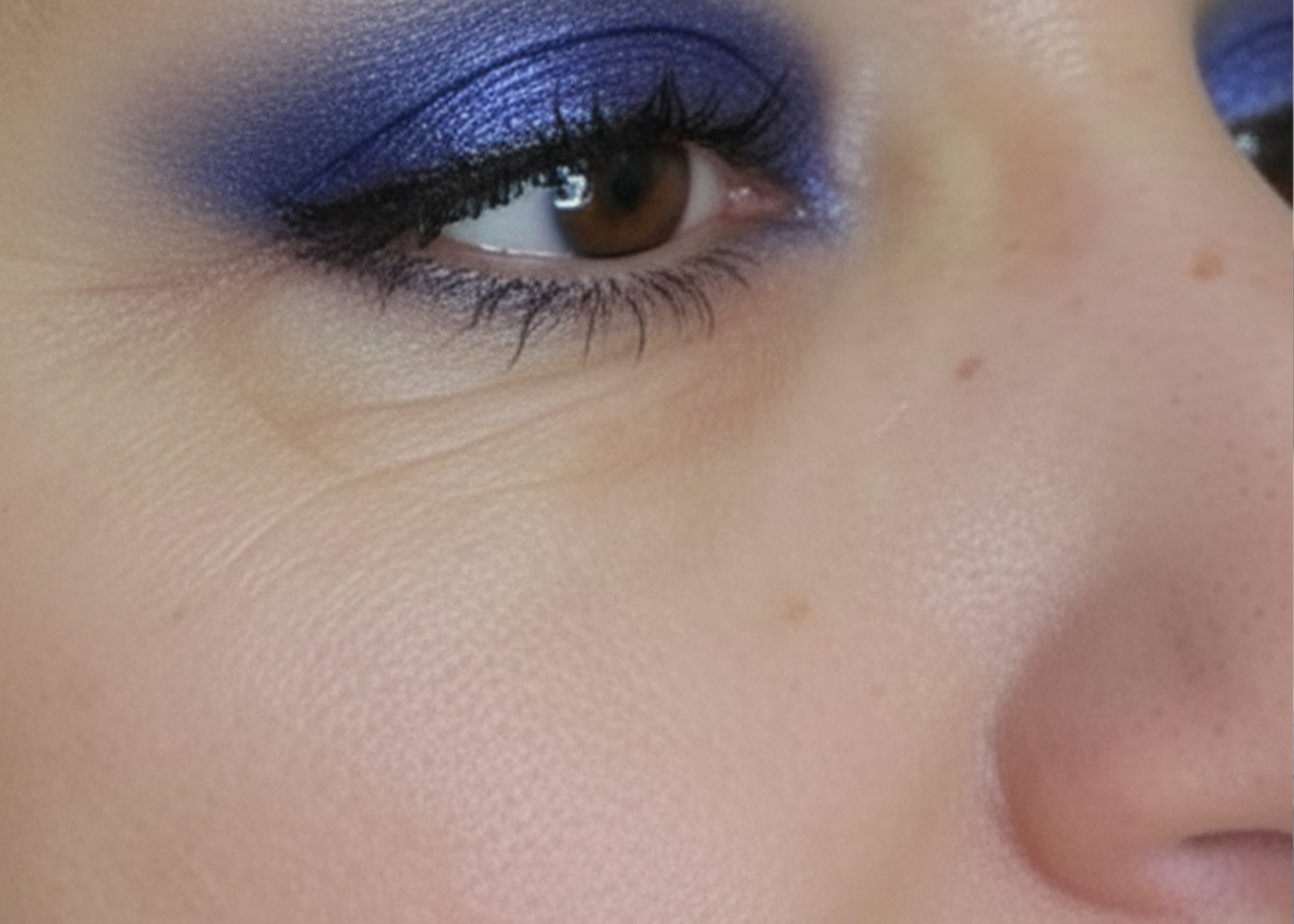 البوتكس غاليا روتس4